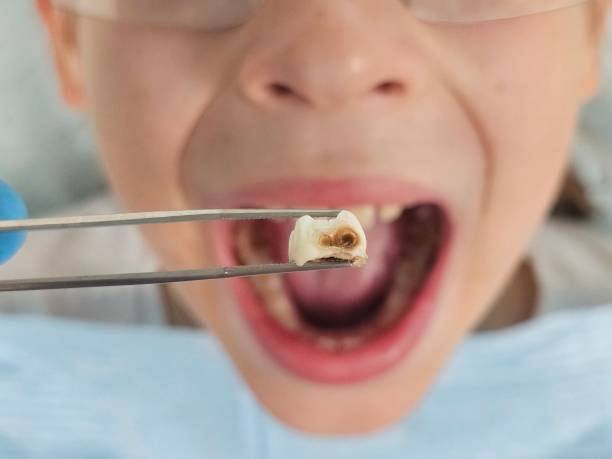 Best Emergency Denture Repair in Los Chaves, NM